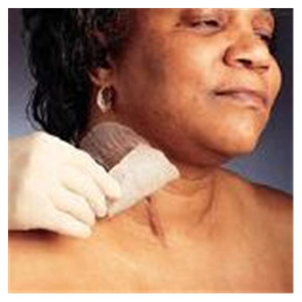 Dressing Scar Mepiform Silicone Gel 1-3/5x12